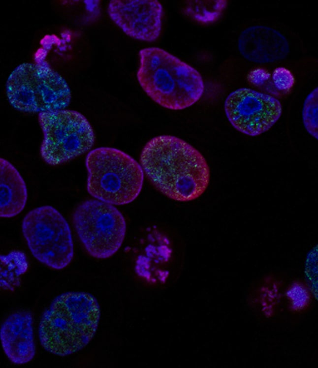 Leveraged-advanced-technologies-to-detect-cancer-and-track-its-spread-to-nearby-lymph-nodes-min